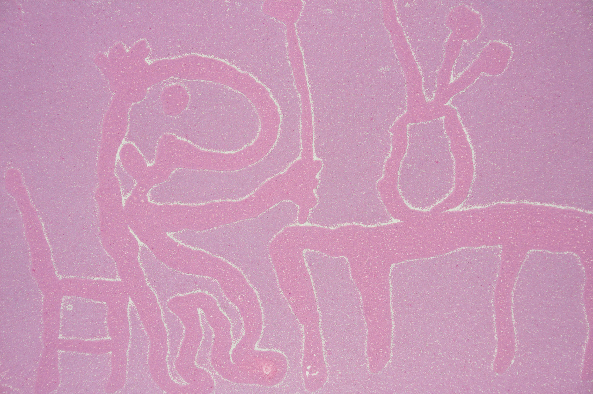 Michael Leunig 'Untitled (Tulip Mania)'